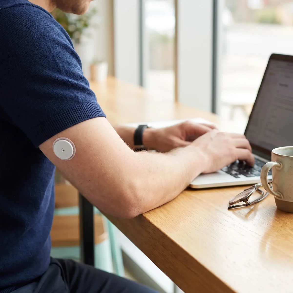 A person working at a laptop wearing a continuous glucose monitor